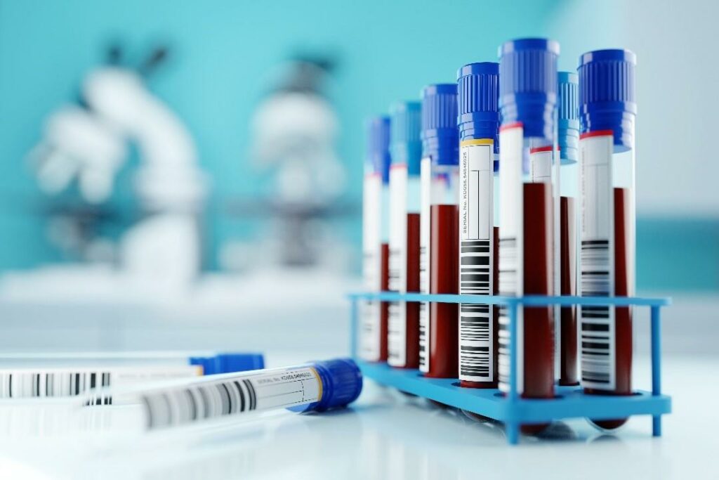 IBSP: Segurança do Paciente - Ferramentas para gerenciamento de risco – Estudo utiliza FMEA para melhorar coleta de sangue 6 IBSP: Segurança do Paciente - Ferramentas para gerenciamento de risco – Estudo utiliza FMEA para melhorar coleta de sangue