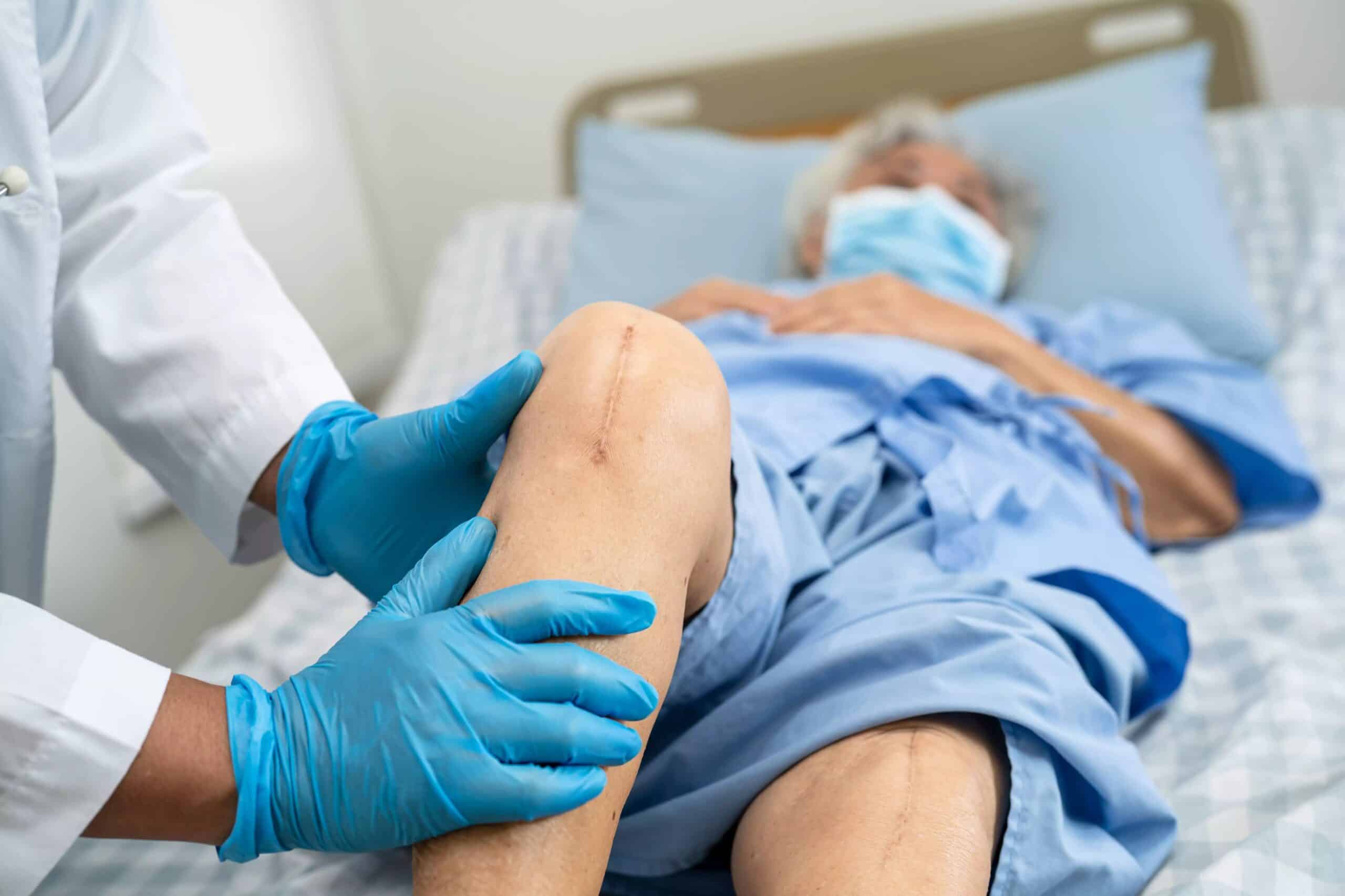 Campanha de melhoria consegue reduzir em até 15% o risco de infecção pós artroplastia