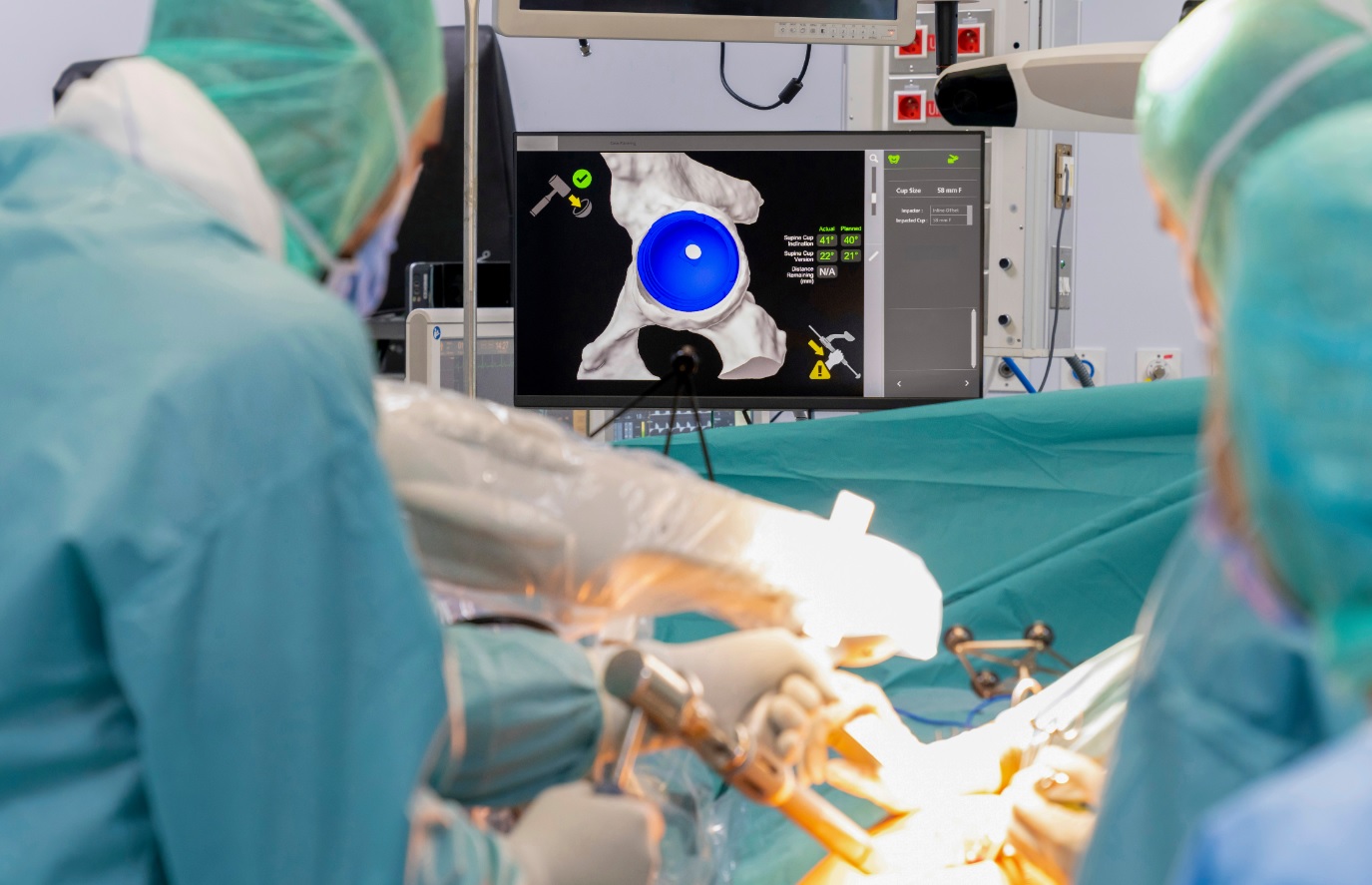 Aspirina ou enoxaparina para prevenção de TEV após artroplastia total de quadril e joelho?