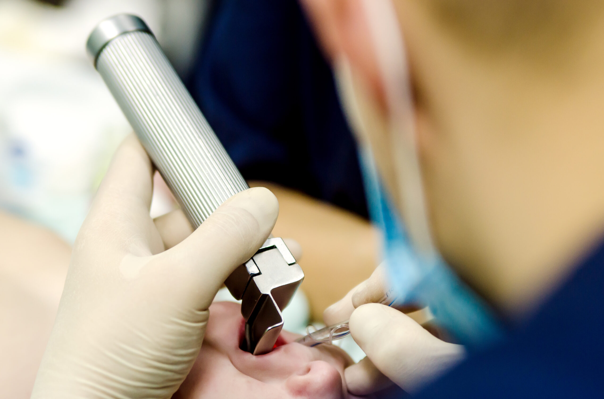 <strong>Entubação em pediatria – Conhecimento é palavra-chave para prevenção de incidentes</strong>