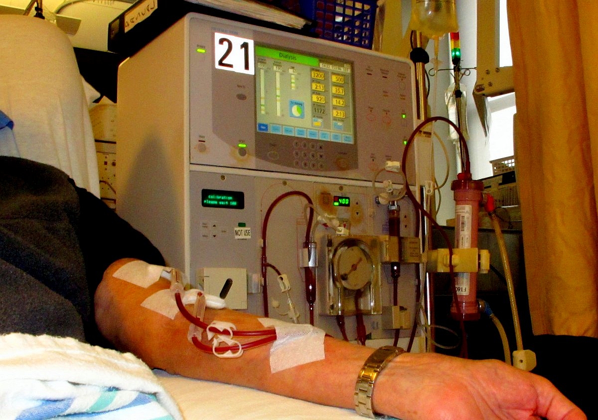 Apenas 4% dos serviços de diálise que atendem pacientes com doença renal crônica têm alta conformidade às práticas de segurança