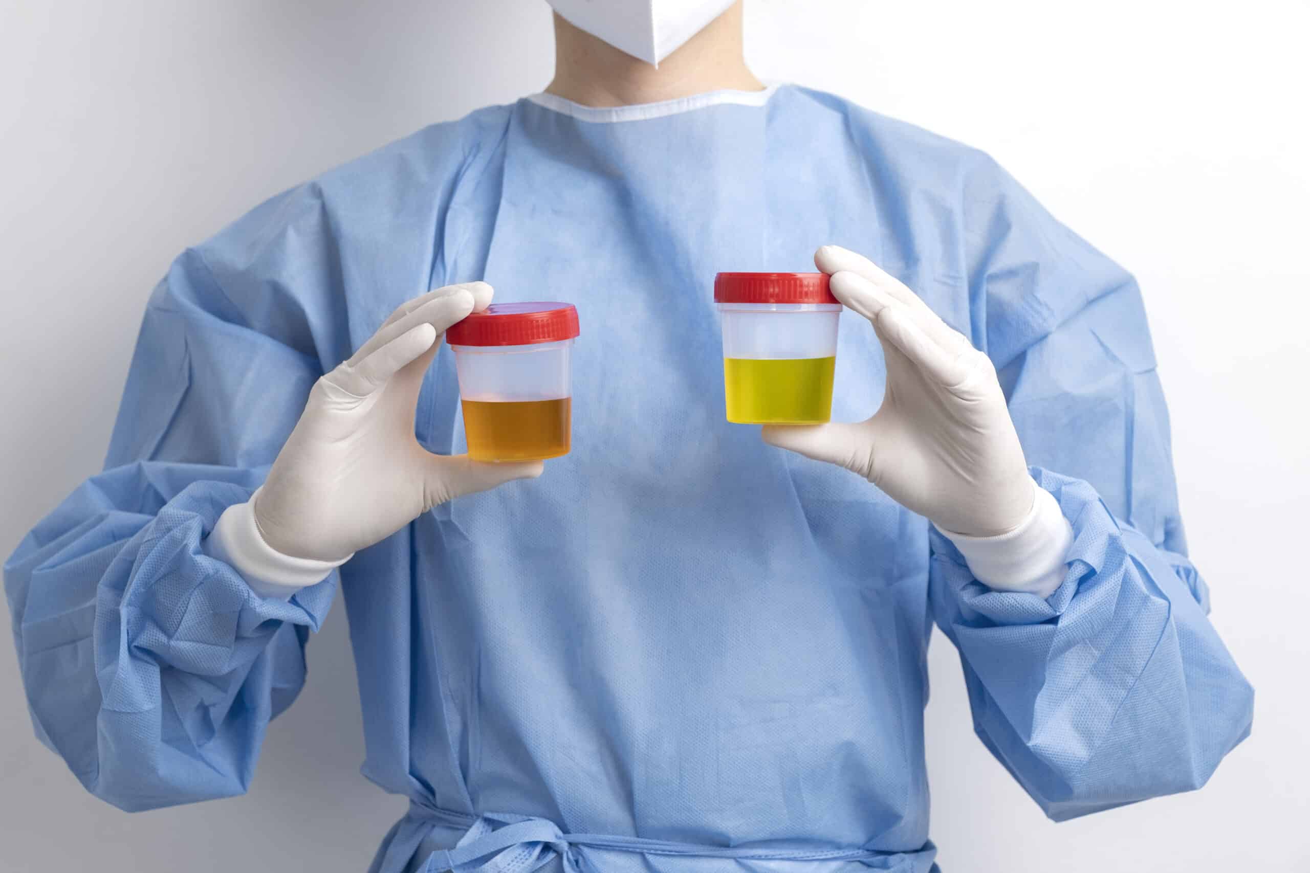 Impactos da gestão diagnóstica no uso indiscriminado de antibióticos