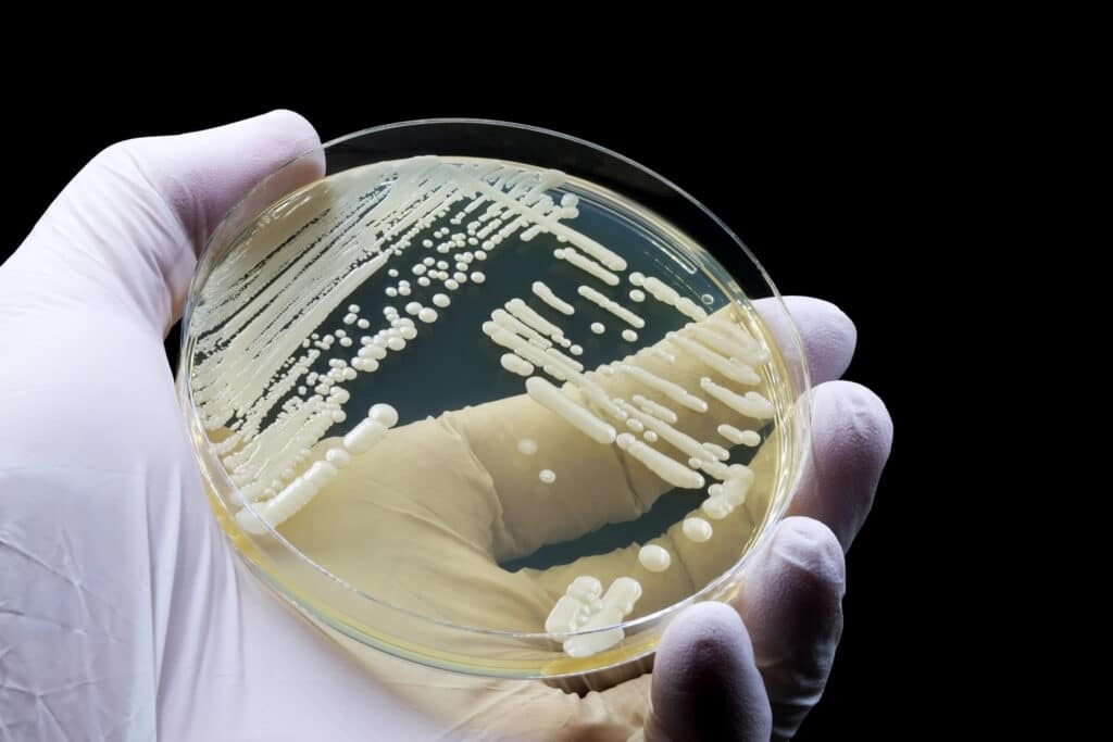 Candida auris: melhores práticas para prevenção e controle de surtos envolvem protocolos, higiene e educação continuada