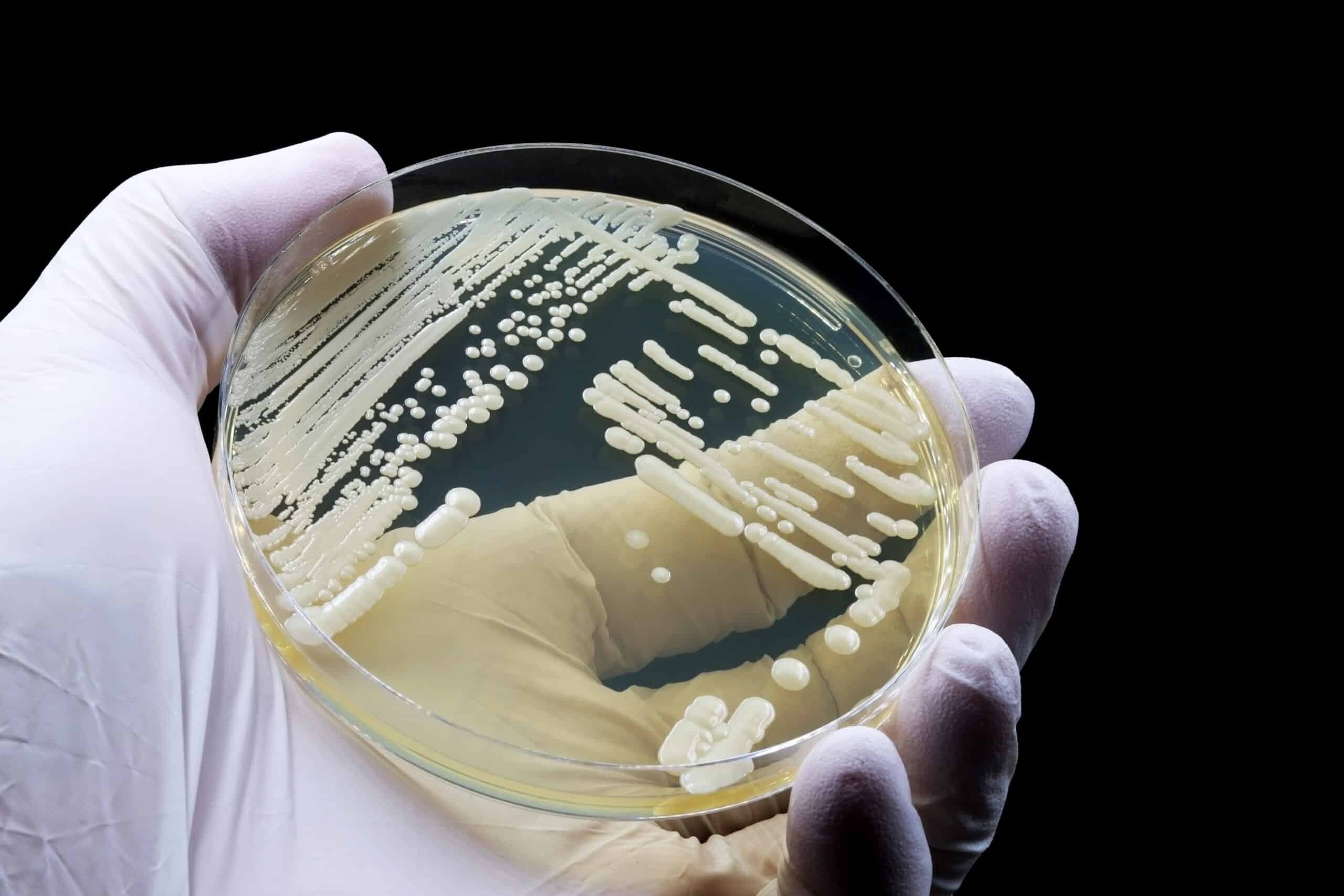 Candida auris: melhores práticas para prevenção e controle de surtos envolvem protocolos, higiene e educação continuada
